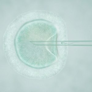 Unravelling assisted conception options ivf